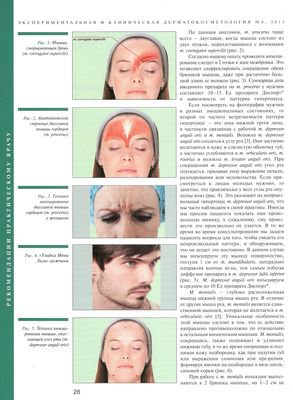 В журнале «Экспериментальная и клиническая дерматокосметология» №4 2013г. опубликована статья «Гендерные особенности применения ботулотоксина типа А»