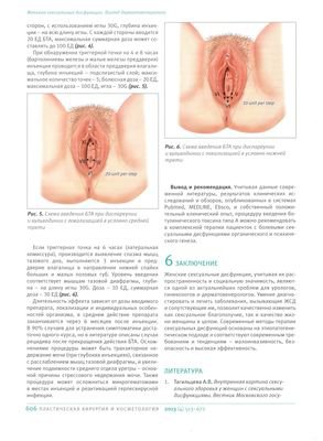 В журнале «Пластическая хирургия и косметология» №4 2013г. опубликована статья «Женские сексуальные дисфункции. Взгляд дерматовенеролога»