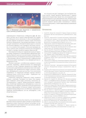 В журнале «Косметика и медицина» 3/2015г. описан случай из практики «Воспаление как составная часть инъекционных косметологических манипуляций»
