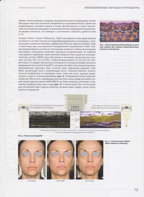 [В журнале "Инъекционные методы в косметологии" опубликована статья "Международный клинический опыт комбинированного применения микросфокусированного ультразвука с визуализацией в реальном времени и инъекционных, нитевых методов и пилингов в эстетической медицине"]