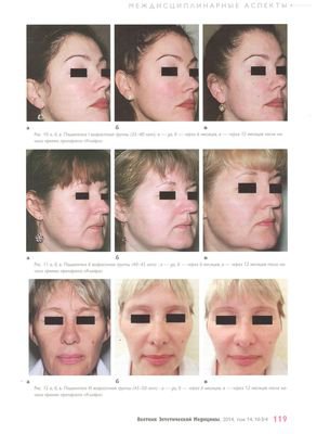 «Вестник Эстетической Медицины» № 3/4, том 13/ 2014 опубликовал клиническое исследование влияния препарата «Клайра» на качество кожи женщин разных возрастных групп