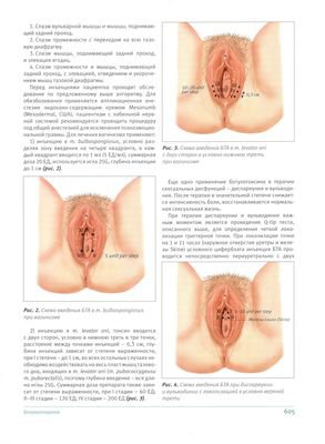 В журнале «Пластическая хирургия и косметология» №4 2013г. опубликована статья «Женские сексуальные дисфункции. Взгляд дерматовенеролога»