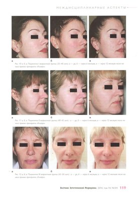 «Вестник Эстетической Медицины» № 3/4, том 13/ 2014 опубликовал клиническое исследование влияния препарата «Клайра» на качество кожи женщин разных возрастных групп